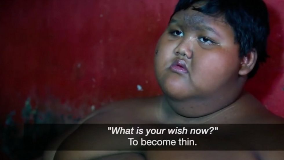 12-Year-Old Arya Permana Loses Enough Weight Enabling Him to Walk to School