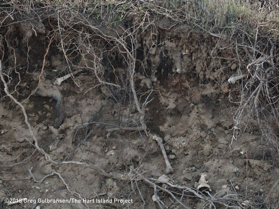 Body Parts are Popping Out of a Mass Grave in New York City